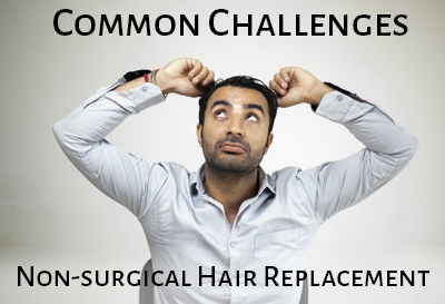 Common Challenges of Non Surgical Hair Replacement