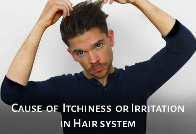 What Causes Itchiness or Irritation In Hair Systems
