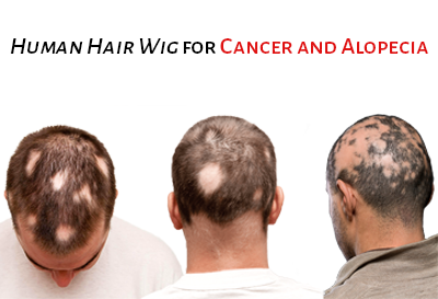 Human Hair Wigs For Cancer Or Alopecia