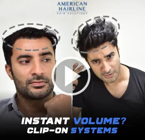 Clip on Hair Systems for Men | Non-Surgical Hair Replacement