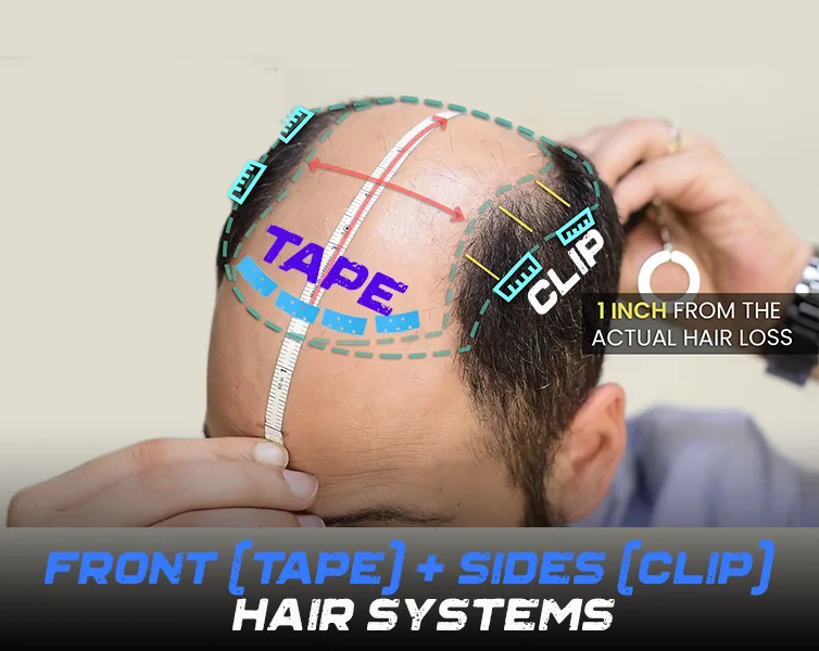 Side Clip-On & Front Tape Hair System for Men | Non-Surgical hair  Replacement in India